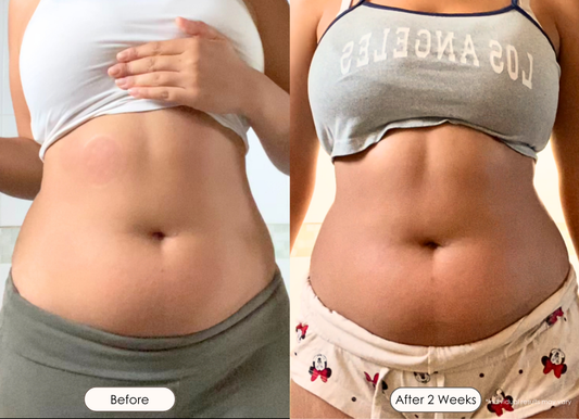 body-sculpting-home-vs-salon-dubai
